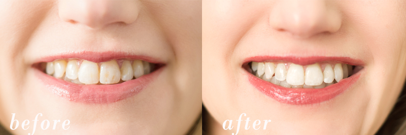 Petite Fashion and Style Blog | Smile Brilliant | Click to Read More...