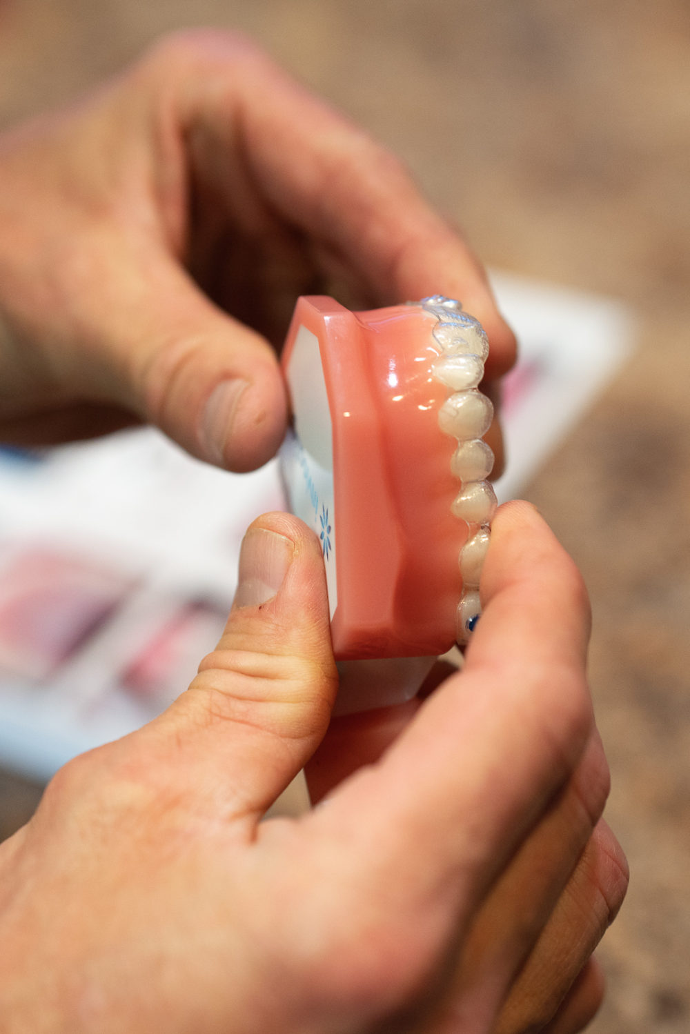 Petite Fashion Blog | Invisalign Review