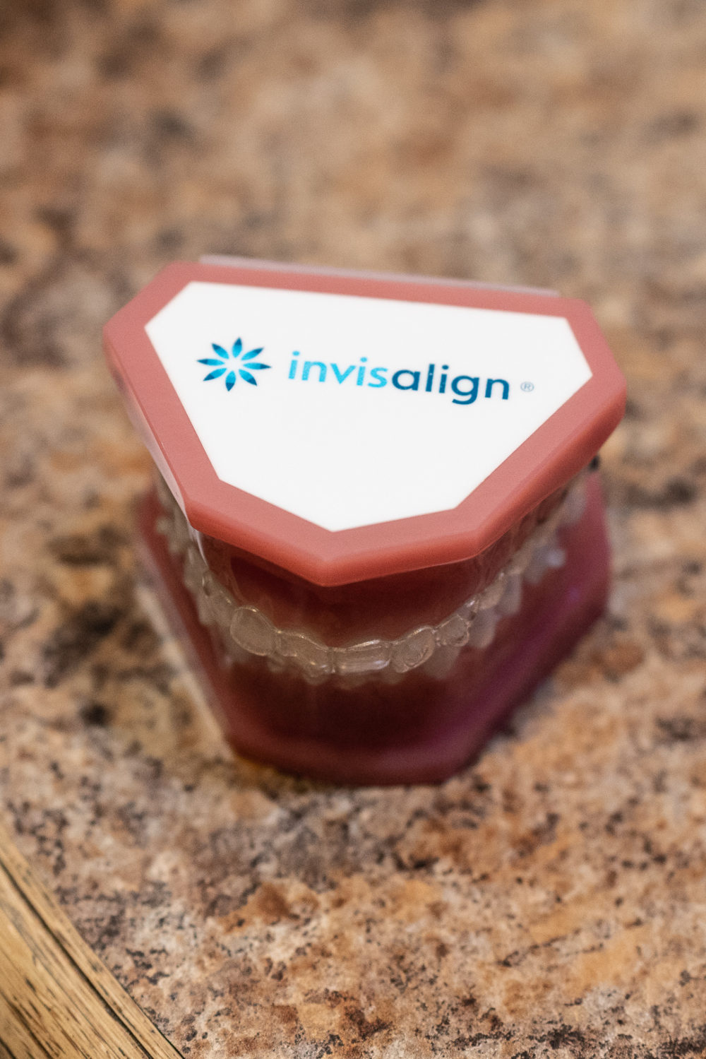 Petite Fashion Blog | Invisalign Review