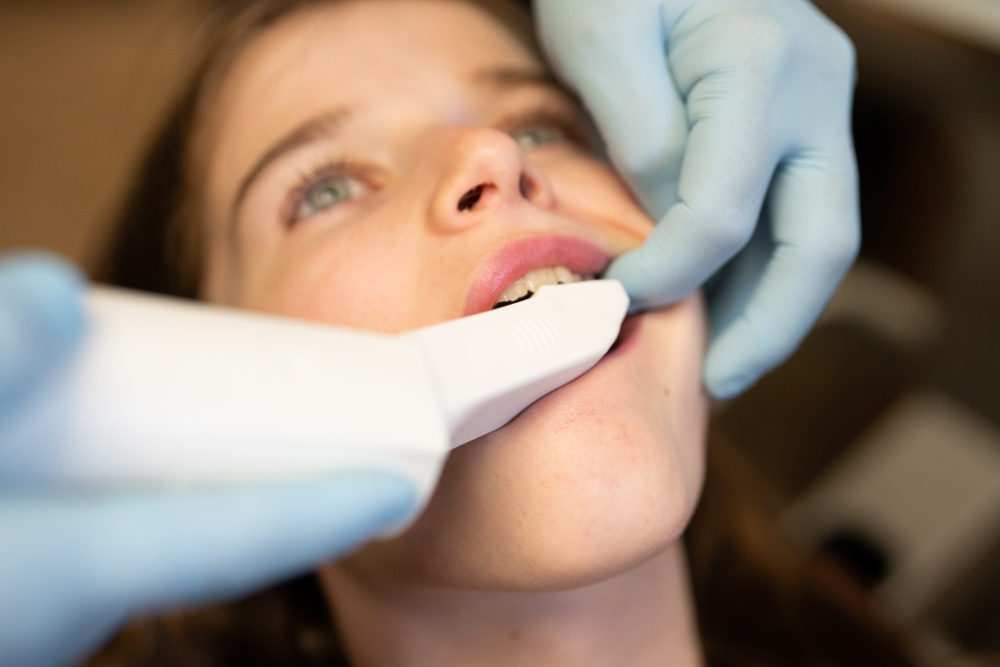 Petite Fashion Blog | Invisalign Review
