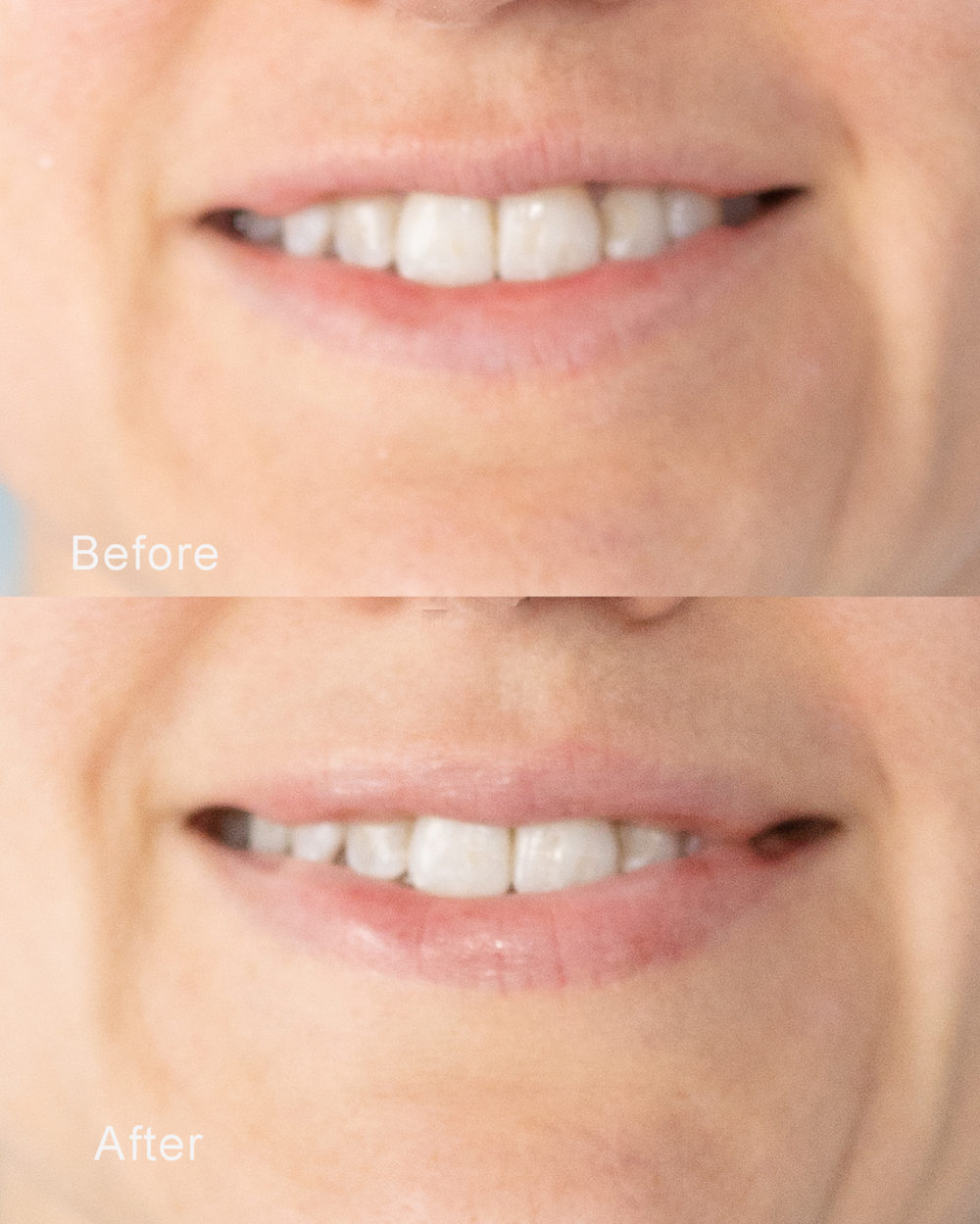 Petite Fashion Blog | Strivectin Anti-Wrinkle Cream Review